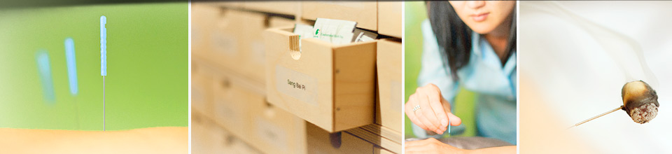Collage of four photos. From left to right: close-up of acupuncture needles inserted in skin, picture of wood box with package of dried herbs, picture of woman inserting acupuncture needle in a patient, close-up of a burning herb called mugwort